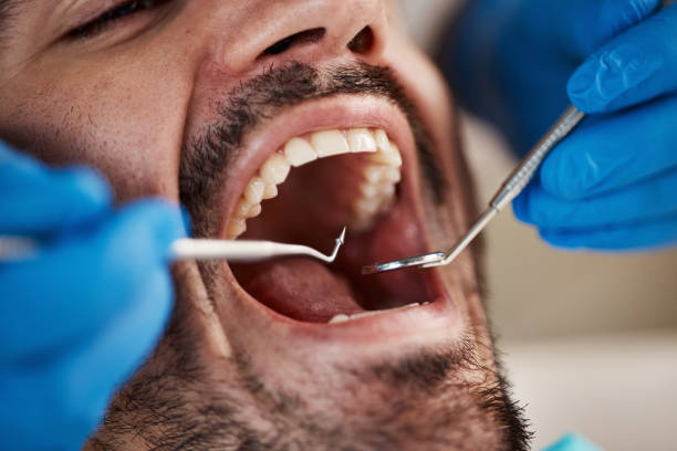 Best Affordable Emergency Dental Care  in Oak Ridge North, TX