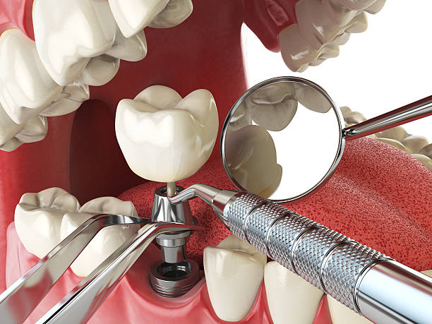 Best Emergency Tooth Extraction  in Oak Ridge North, TX