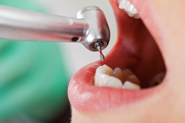 Best Walk-In Dentist Near Me  in Oak Ridge North, TX